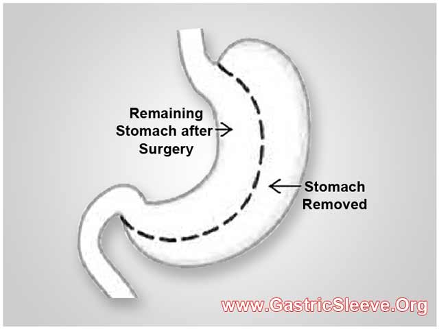 home-remedies-sore-throat-baby-how-to-make-a-weight-loss-graph-maker